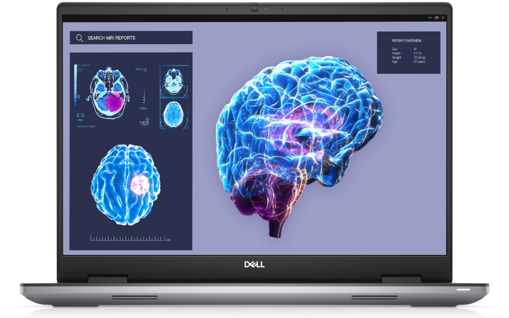 Dell | Mobile Precision 7680 | 16 " | WVA | FHD+ | 1920 x 1200 pixels | Anti-glare | Intel Core i9 | i9-13950HX | 32 GB | Solid-state drive capacity 1000 GB | NVIDIA RTX 2000 Ada | GDDR6 | 8 GB | Windows 11 Pro | 802.11ax | Keyboard language Estonian | Keyboard backlit | Warranty 36 month(s)